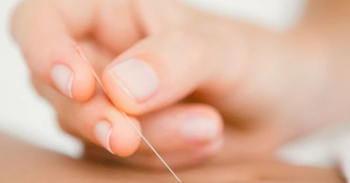 London Acupuncture Clinics